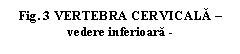 Text Box: . 3 VERTEBRA CERVICALA  vedere inferioara -