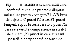 Text Box: . 11.18. stabilitatea restaurarii este conferita numai de punctele dispuse ocluzal de punctul tangent P1. AB linia de actiune;C punct fulcrum;P1 punct tangent, supus la forfecare ;P2 punct in care se exercita compresiune in stratul de ciment ;P3 punct in care stressul poseda o componenta de tensiune