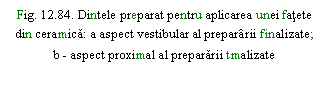 Text Box: . 12.84. Dintele preparat pentru aplicarea unei fatete din ceramica: a aspect vestibular al prepararii finalizate;
b - aspect proximal al prepararii tmalizate
